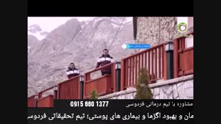 درمان خانگی اگزما درمان جای جوش