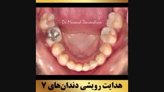 ارتودنتیست تهران | دکتر داودیان