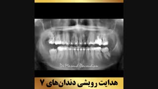 متخصص ارتودنسی | دکتر داودیان