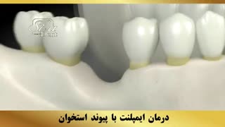 کلینیک دندان در تهران | سیمادنت