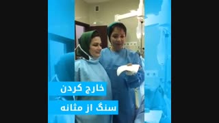 خارج کردن سنگ از مثانه توسط دکتر سیمین وحیدی کربوکسی تراپی
