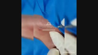 فیلم سابسیژن صورت دکتر حمیده آقایی کلینیک زیبایی