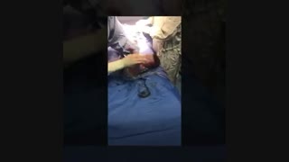 فیلم عمل زایمان سزارین
