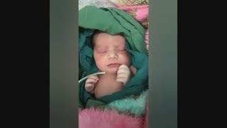 فیلم عمل زایمان سزارین