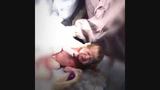 فیلم عمل زایمان سزارین