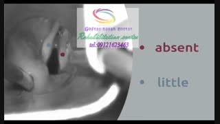 بهترین مراکز تصویربرداری حنجره در کرج|گفتار توان گستر البرز 09121623463