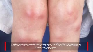 مشکلات پوستی نشانه چه بیماری ای است؟