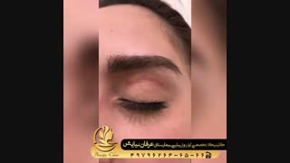 فیلم کاشت ابرو