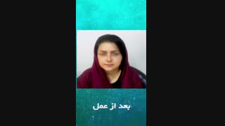 نمونه جراحی بینی