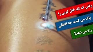 وقتی که یک خال کوبی را پاک می کنید، چه اتفاقی رخ می دهد؟