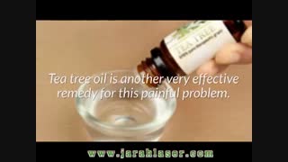 بهترین روش‌های درمان خانگی کیست مویی یا سینوس پیلونیدال - کلینیک مهنا