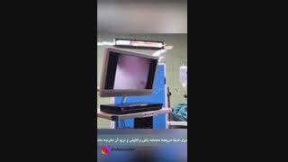 عملیه ازاله الورم اللیفی