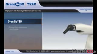 کامپوزیت VOCO - Grandio SO