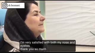 یک هفته بعد از جراحی همزمان بینی و پلک