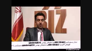 پسوریازیس_درمان