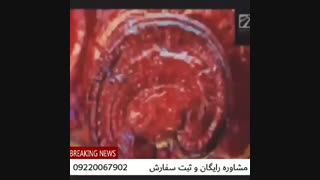 درمان قطعی بیماریها توسط قارچ گانودرما