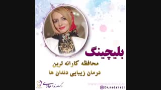 بلیچینگ دندان، درمانی ایمن و موثر