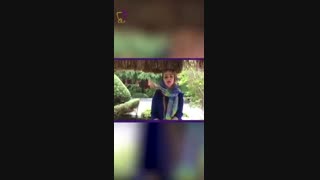 دانستنی های مهم در مورد انواع لمینت دندان