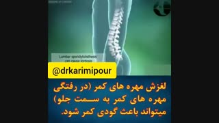 علل اصلی گودی کمر