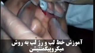 آموزش خط لب و رژ لب به روش میکروپیگمنتیشن
