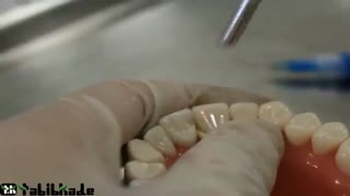 ونیر کامپوزیت و هزینه آن