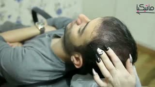 اسکالپ میکروپیگمنتیشن سر