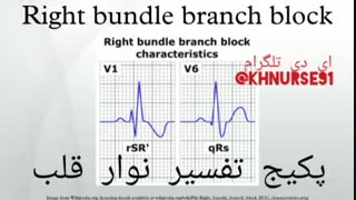 بلوکهای شاخه ای قلب