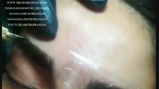 آموزش میکروبلیدینگ