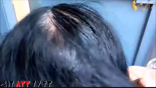 کلیپ رفع سفیدی مو با  لیمو و روغن نارگیل + ماسک مو