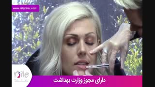 تزریق ژل | فیلم تزریق ژل | کلینیک پوست و مو نیل | شماره 17