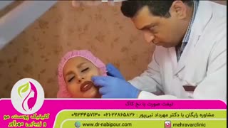 لیفت صورت با نخ کاگ