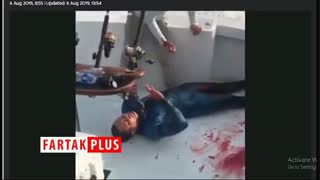 لحظه دلهره آور نجات غواص زخمی پس از حمله مرگبار کوسه