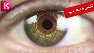 آشنایی با اسکنر عنبیه