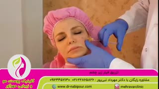 فیلر زیر چشم ترمیم زیبایی دندان