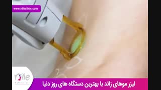 لیزر موهای زائد | فیلم لیزر موهای زائد | کلینیک پوست و مو نیل | شماره 15