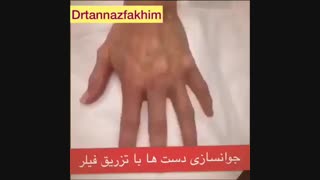 جوانسازی دست بدون جراحی و بدون درد دندانپزشکی کودکان