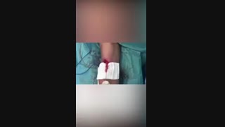 جراحی ترمیم پارگی دو سر بازویی در یکی از قهرمانان دنیای فیتنس