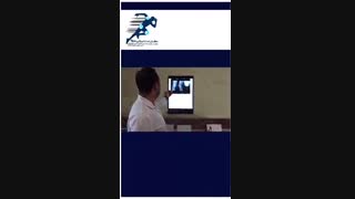 تشخیص آرتروز  با رادیوگرافی