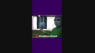 فیلم عمل تعویض مفصل ران