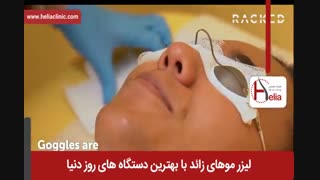 لیزر موهای زائد | فیلم لیزر موهای زائد | کلینیک پوست و مو هلیا | شماره 20