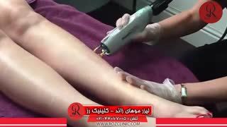 لیزر موهای زائد | لیزر مو | کلینیک پوست و مو رز | شماره 18