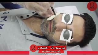 لیزر موهای زائد | لیزر مو | کلینیک پوست و مو رز | شماره 20