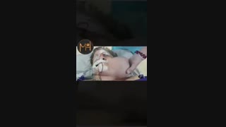 توده بزرگ صورت