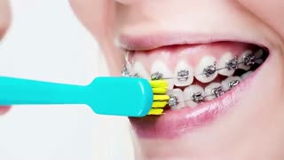 همکاری بیمار با ارتودنتیست | دکتر لادن طیبی