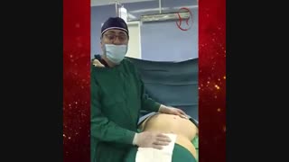 لیپوماتیک پشت در افرادی که عمل زیبایی شکم انجام می دهند