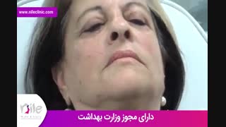 تزریق ژل | فیلم تزریق ژل | کلینیک پوست و مو نیل | شماره 19