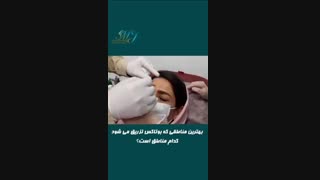پاسخ به سوالات متداول شما در مورد تزریق بوتاکس