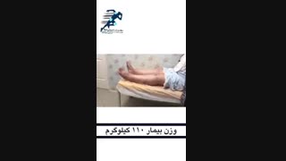 معاینه بیمار یک هفته بعد از تعویض مفصل زانو