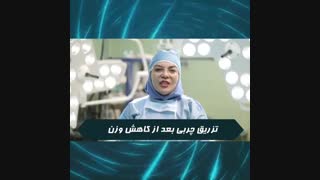 تزریق چربی پس از کاهش وزن