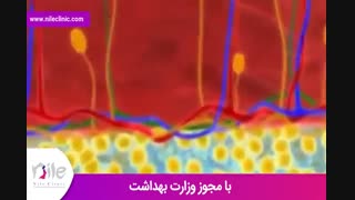 لیپوماتیک | فیلم لیپوماتیک | کلینیک پوست و مو نیل | شماره 21